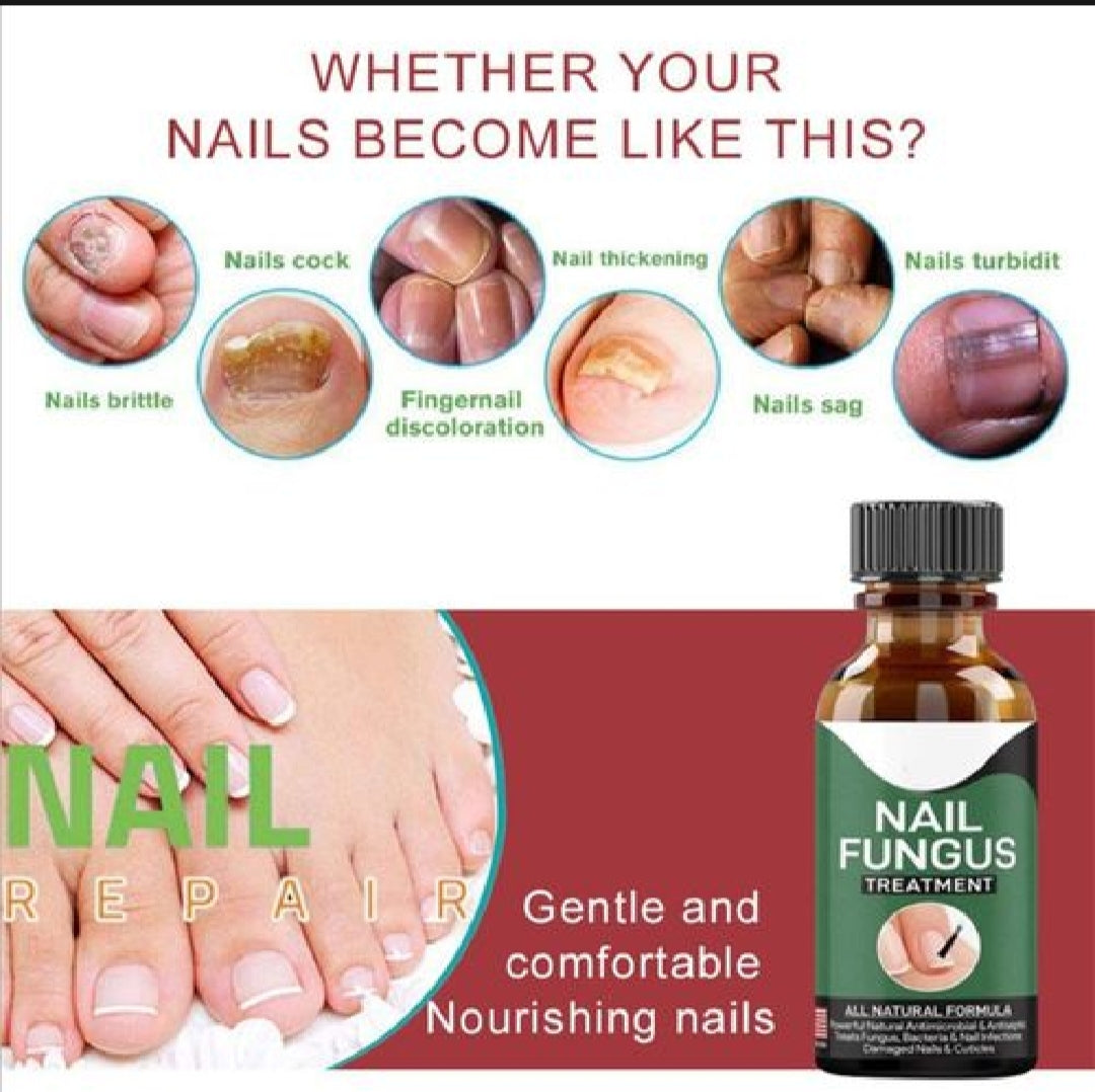 Natural Antifungal Oil for Damaged Nails