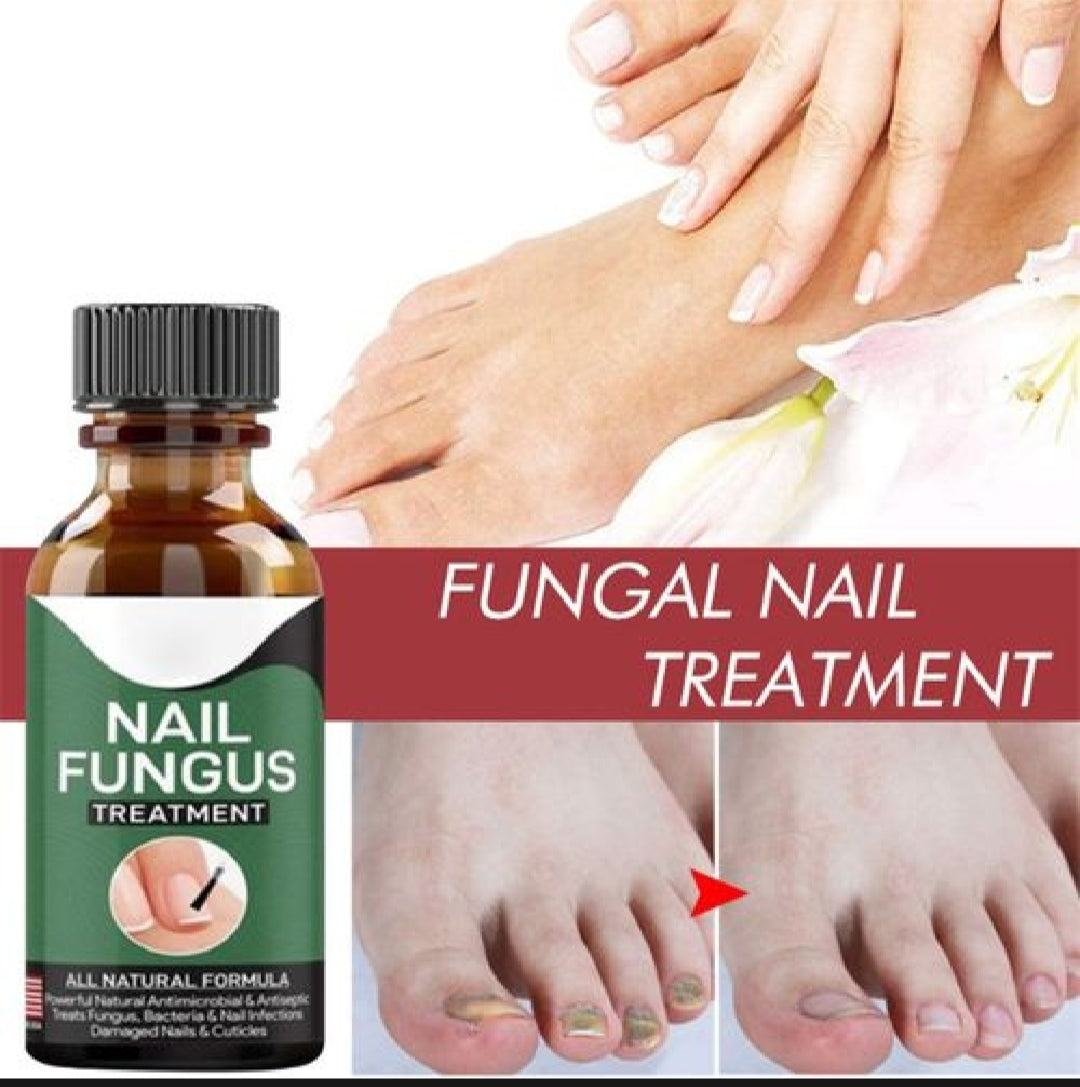 Natural Antifungal Oil for Damaged Nails
